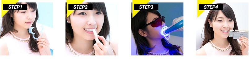  サロンホワイトニング情報サイト